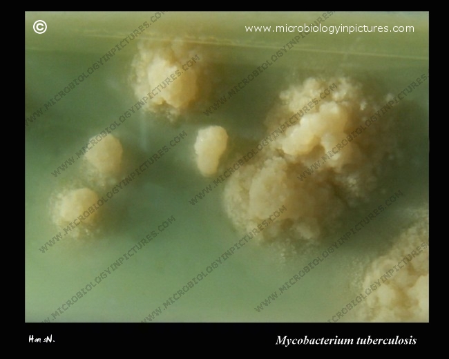 mycobacterium tuberculosis colony close-up, growth on L-J medium